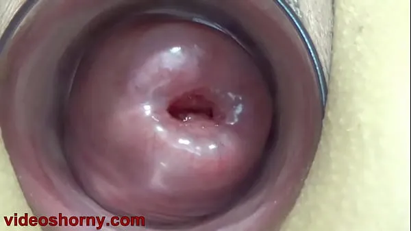 Watch Cervix Fucking pumped uterus prolapsed and t.. b. a. pussy and tormented energy Movies